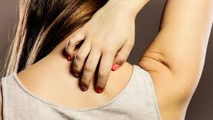 What Is Psoriasis