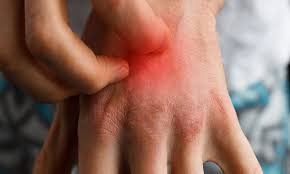 What Are The Causes Of Psoriasis