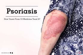 Does Omega 3 Help Psoriasis